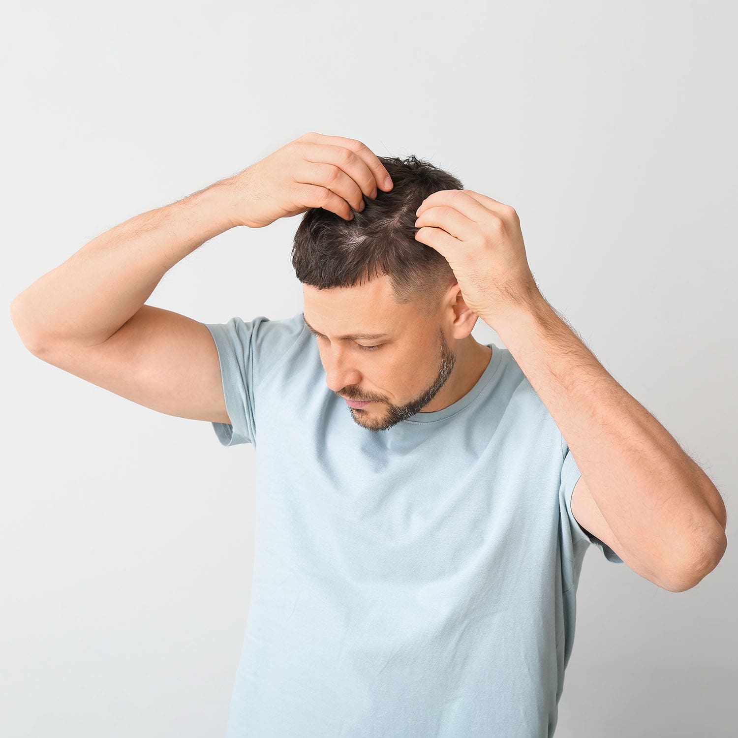 Man touching his hair to check for thinning spots